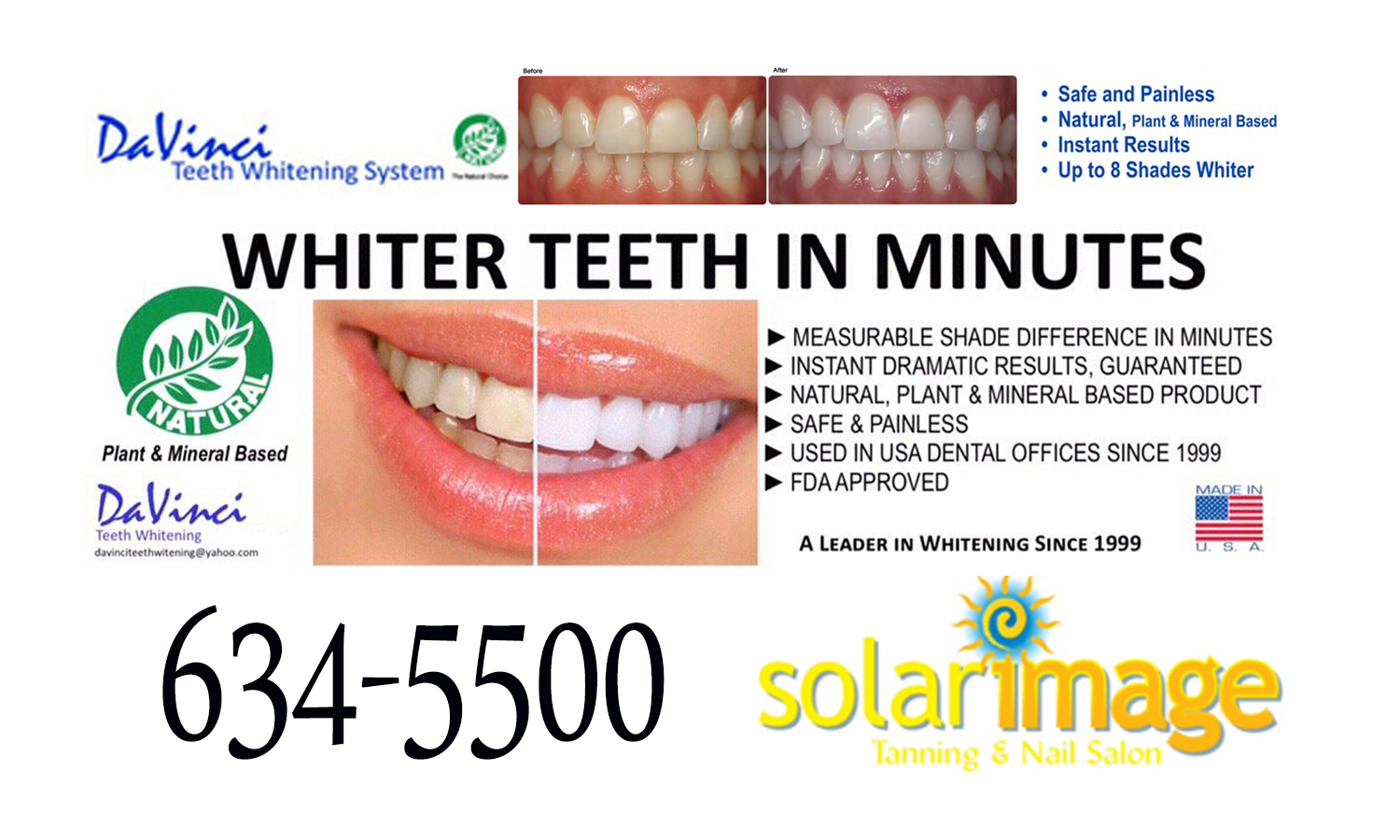 optident teeth whitening forum